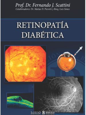 Retinopatia Diabetica - Scattini